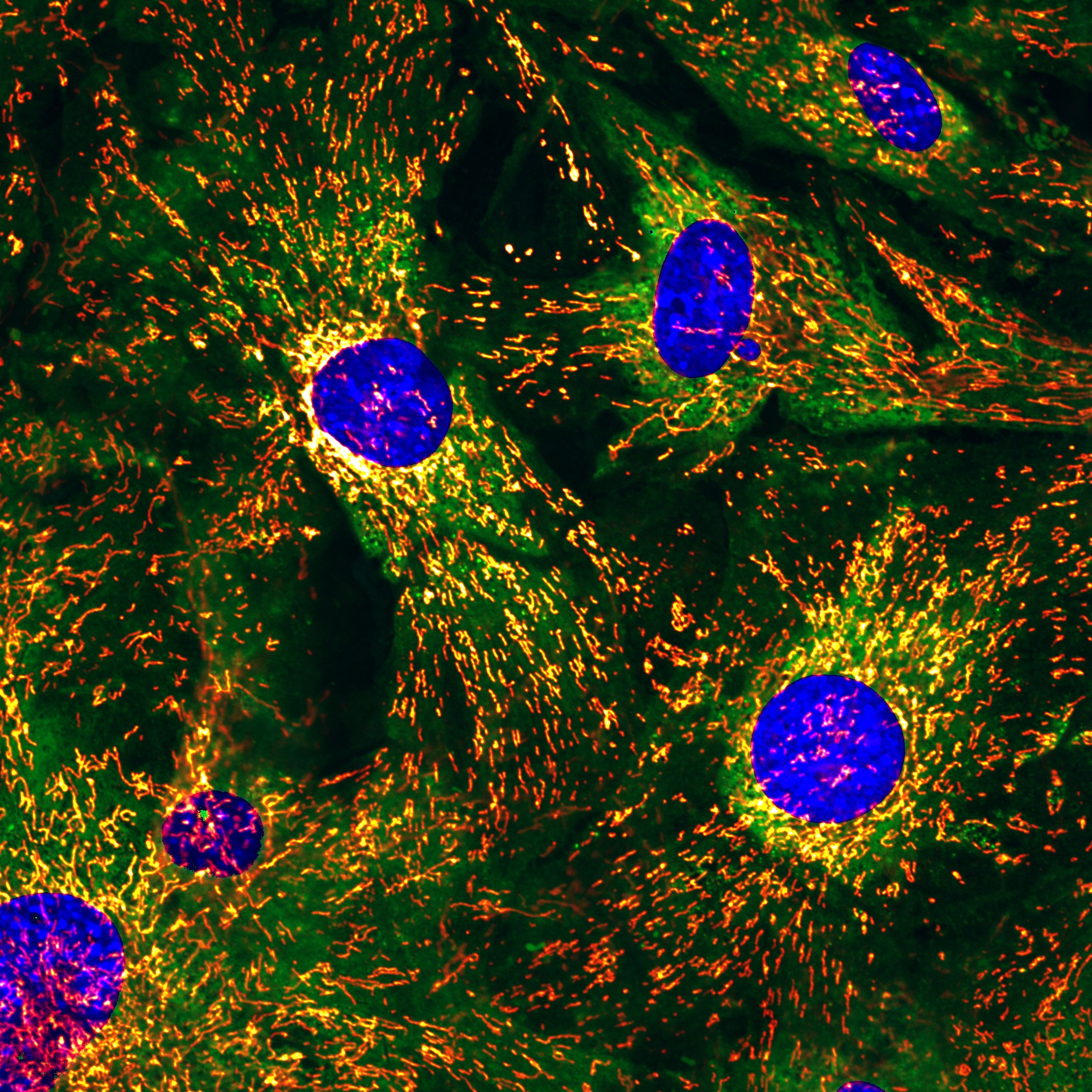 Microscopy image of mitochondria in health and disease - . by agustina salis torres